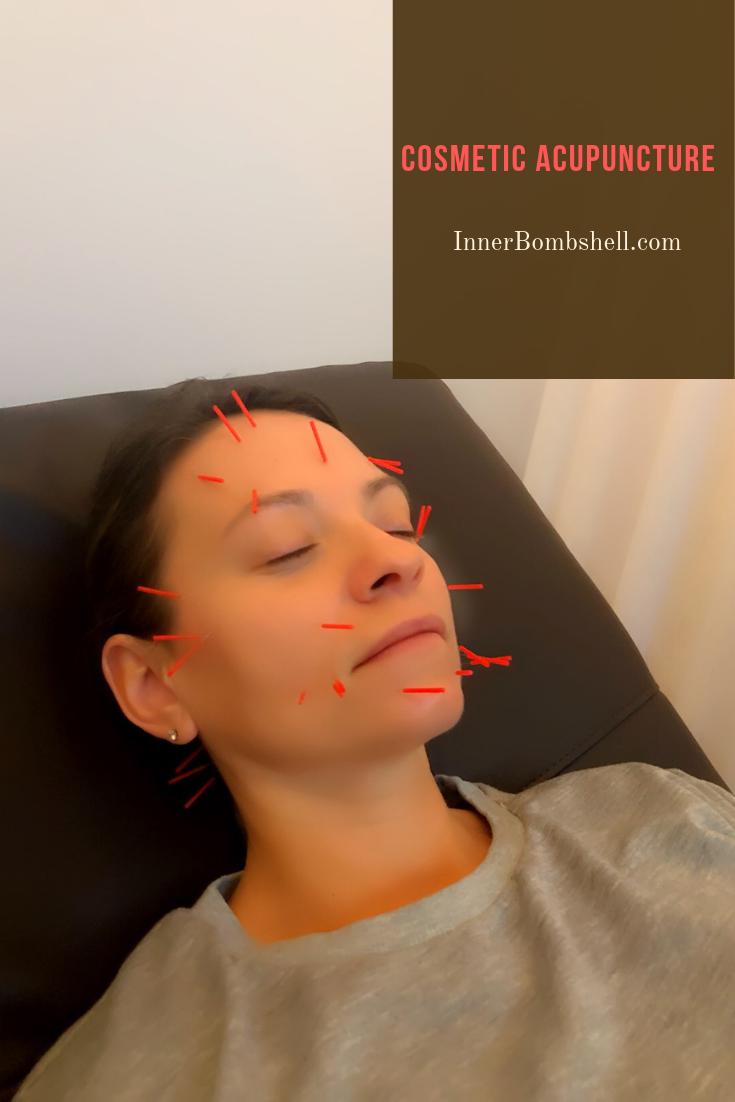 Cosmetic Acupuncture, Skincare, Toxic Free, Wrinkles, Fine Lines